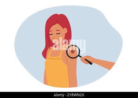 Melanoma o tumore maligno trovato sulla spalla di una donna in piedi vicino a una lente di ingrandimento Illustrazione Vettoriale