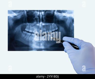 Primo piano di un medico di sesso maschile che indica l'immagine radiografica dei denti nello studio dentistico. Foto Stock