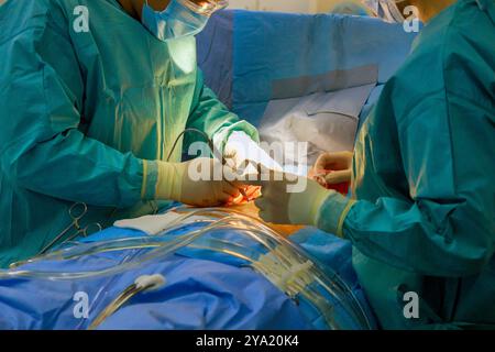 Il team chirurgico esegue la chirurgia a cuore aperto nella sala operatoria dell'ospedale Foto Stock