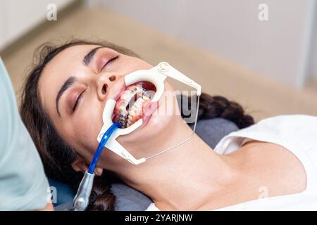 Vista dall'alto della donna caucasica con staffe di legatura sui denti che indossano un divaricatore. Concetto di ortodonzia e stomatologia. Foto Stock