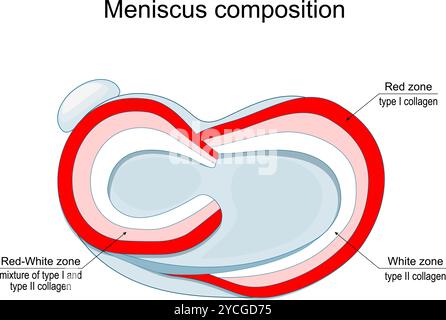 Composizione del menisco. Vista dall'alto dell'articolazione del ginocchio umano. Anatomia del menisco. Tipi di collagene nella zona bianca e nella zona rossa. Poster vettoriale Illustrazione Vettoriale