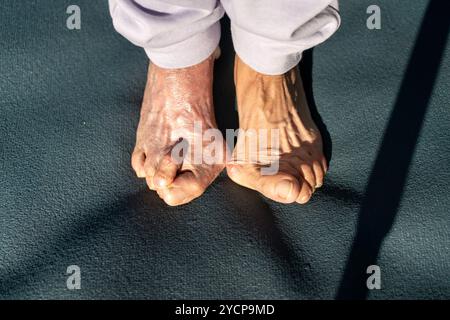 La ripresa sopraelevata cattura i piedi di una donna anziana, mostrando effetti visibili di bunion e allux valgus, deformità dell'articolazione MTP che collega l'alluce al piede Foto Stock