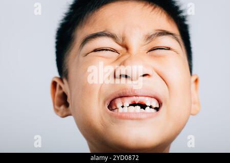 Ragazzo senza sorrisi superiori, ampio spazio visibile. Crescita dentale del bambino isolata su bianco. Dente gioioso Foto Stock