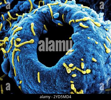 Micrografia elettronica a scansione colorata di particelle del virus di Marburg (gialla) sia in erba che attaccata alla superficie di una cellula di VERO E6 infetta (blu). Foto Stock