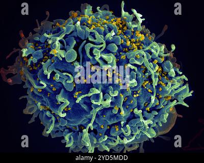 Micrografia elettronica a scansione di una cellula H9 T umana (blu/verde) infettata da particelle del virus HIV (giallo). Foto Stock