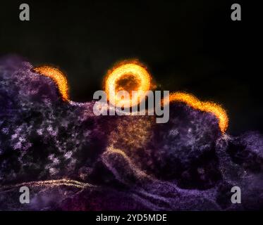 Micrografia elettronica di trasmissione di particelle del virus HIV-1 (giallo colorato/oro) che si replica da una cellula T H9 infetta da HIV (viola). Foto Stock