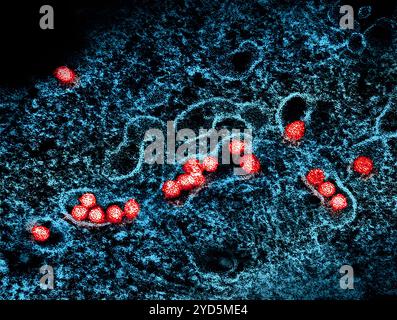 Micrografia elettronica di trasmissione delle particelle del virus del Nilo occidentale (rosso) che si replicano all'interno del citoplasma di una cellula infetta VERO E6 (blu). Foto Stock