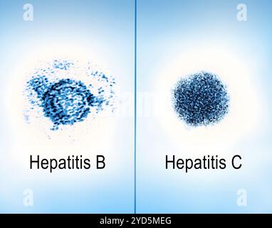 Immagini a micrografia elettronica a trasmissione affiancata di virioni dell'epatite B e C. Foto Stock