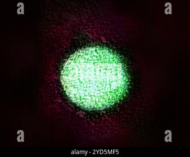 Micrografia elettronica a trasmissione colorata di un virion dell'epatite C. Foto Stock