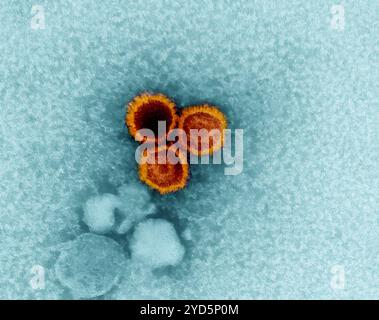 Un micrografo elettronico che mostra tre particelle del virus di Epstein-Barr (EBV) colorate di rosso-arancione. 2024 : gli scienziati trovano punti deboli sul virus Epstein-Barr. Foto Stock