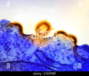 Micrografia elettronica di trasmissione di particelle del virus HIV-1 (giallo colorato/oro) che si replica da una cellula T H9 infetta da HIV (blu). Foto Stock