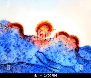 Micrografia elettronica di trasmissione di particelle del virus HIV-1 (colorate in rosso/giallo) che si replica da un linfocito T H9 infetto da HIV (blu). Foto Stock
