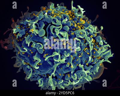 Micrografia elettronica a scansione di una cellula H9 T umana (blu/verde) infettata da particelle del virus HIV (giallo). Foto Stock