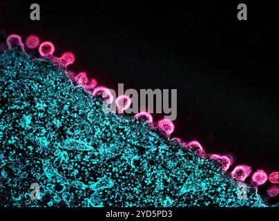 Micrografia elettronica a trasmissione colorata di particelle del virus HIV-1 (rosa) che germogliano e si replicano da una cellula H9 T (verde acqua). Foto Stock