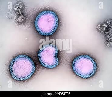 Particelle del virus dell'influenza B, colorate viola e blu, isolate da un campione di paziente e poi propagate in colture cellulari. Foto Stock