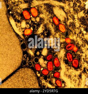 Micrografia elettronica a trasmissione colorata di particelle del virus mpox (arancione) trovate all'interno di una cellula infetta (marrone e giallo). Foto Stock