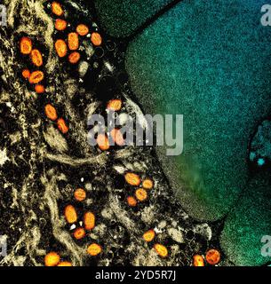 Micrografia elettronica a trasmissione colorata di particelle del virus mpox (arancione) trovate all'interno di una cellula infetta (marrone e verde). Foto Stock