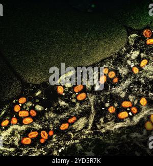 Micrografia elettronica a trasmissione colorata di particelle del virus mpox (arancione) trovate all'interno di una cellula infetta (marrone), coltivate in laboratorio. Foto Stock