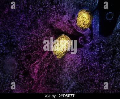 Micrografia elettronica a trasmissione colorata di due particelle mature del virus mpox (gialla) attaccate alla superficie di una cellula infetta VERO E6. Foto Stock