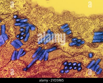 Micrografia elettronica a trasmissione colorata di particelle del virus della rabbia (blu). Foto Stock