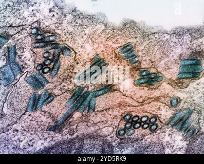 Micrografia elettronica a trasmissione colorata di particelle del virus della rabbia (tè). Foto Stock