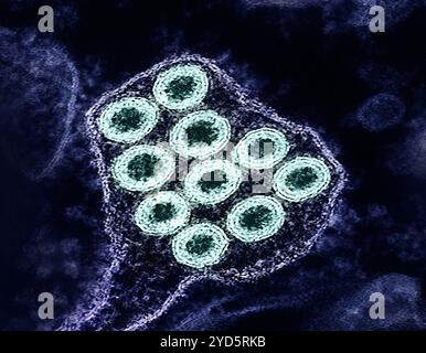 Micrografia elettronica a trasmissione colorata di particelle del virus della rabbia (verde). Foto Stock