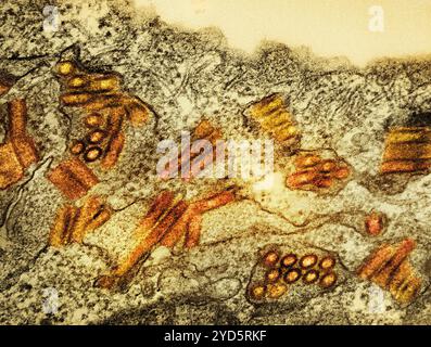Micrografia elettronica a trasmissione colorata di particelle del virus della rabbia (arancione). Foto Stock