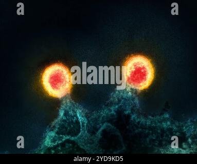 Micrografia elettronica a trasmissione colorata di due particelle di virus HIV-1 rosso/giallo germogliato dalla membrana plasmatica di un tè cellulare H9 T infetto. HIV- 1 particelle di virus che si stanno espandendo dalla cellula 016867 214 Foto Stock