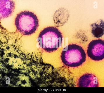 Micrografia elettronica di trasmissione di particelle del virus HIV-1 rosa che si replica dalla membrana plasmatica di una cellula H9 T infetta. Virus HIV-1 016867 218 Foto Stock
