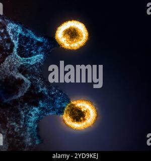 Micrografia elettronica a trasmissione colorata di due particelle di virus HIV-1 gialle che si formano dalla membrana plasmatica di un blu di cellule H9 T infetto. HIV- 1 particelle di virus che si stanno espandendo dalla cellula 016867 215 Foto Stock