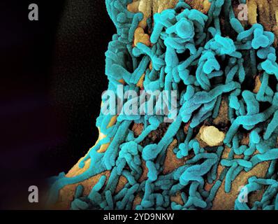 Micrografia elettronica a scansione colorata di particelle del virus di Marburg tè sia in erba che attaccata alla superficie di un oro cellulare VERO E6 infetto. Marburg virus Particles 016867 006 Foto Stock