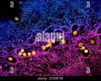 Micrografia elettronica di trasmissione di particelle d'oro del virus del Nilo occidentale che si replica all'interno del citoplasma di una cellula VERA E6 infetta rosa/viola/blu. Virus del Nilo occidentale 016867 046 Foto Stock