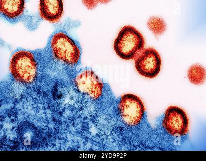Micrografia elettronica di trasmissione di particelle del virus HIV-1 colorate rosso/giallo che si replica da un blu di cellule T H9 infetto da HIV. Particelle di virus HIV-1 016867 035 Foto Stock