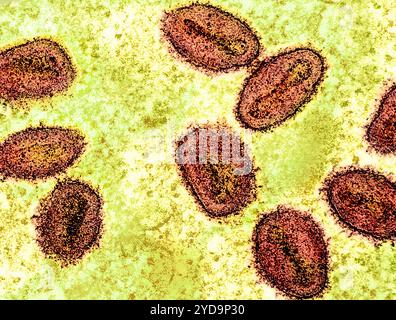 Micrografia elettronica a trasmissione colorata di particelle rosse del virus mpox trovate all'interno di una cellula verde infetta, coltivate in laboratorio. Virus Mpox 016867 045 Foto Stock