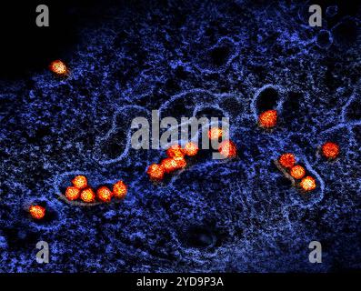 Micrografia elettronica di trasmissione di particelle del virus del Nilo occidentale arancione / oro che si replica all'interno del citoplasma di un VERO E6 infetto cellula blu. Virus del Nilo occidentale 016867 049 Foto Stock
