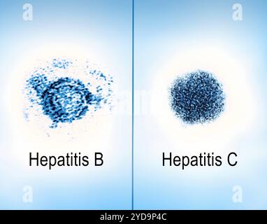 Immagini a micrografia elettronica a trasmissione affiancata di virioni dell'epatite B e C. Epatite B e C 016867 054 Foto Stock