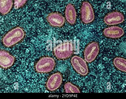 Micrografia elettronica a trasmissione colorata di particelle del virus mpox rosa/oro trovato all'interno di una cellula infetta di tè. Virus Mpox 016867 043 Foto Stock