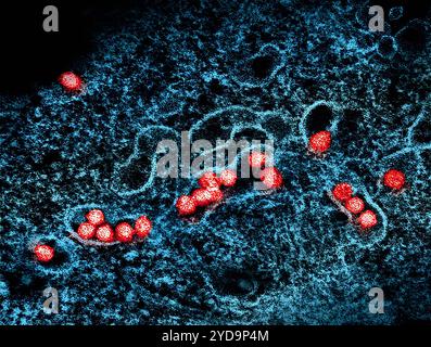 Micrografia elettronica di trasmissione di particelle del virus del Nilo occidentale rosso che si replica all'interno del citoplasma di un VERO E6 infetto blu cellulare. Virus del Nilo occidentale 016867 047 Foto Stock