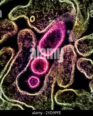 Micrografia elettronica a trasmissione colorata di particelle di virus Nipah extracellulare maturo rosa vicino alla periferia di un verde cellulare VERO infetto. Particelle di virus Nipah 016867 081 Foto Stock