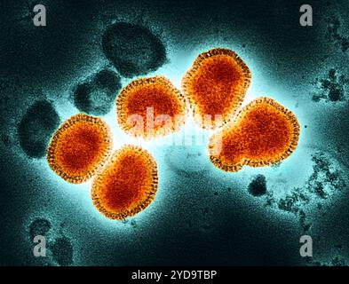 Micrografia elettronica a trasmissione colorata di particelle del virus dell'influenza A, arancione colorato e oro, isolato da un campione paziente e poi propagato in coltura cellulare. L'influenza A può infettare sia gli esseri umani che gli animali, compresi uccelli e suini. Più specificamente, questa immagine mostra il ceppo influenzale H3N2, isolato da un paziente in Victoria, Australia, nel 1975. Notevole per la formazione di particelle sferiche/virioni raffigurate e virioni filamentose, questo ceppo storico può essere impiegato per studiare l'ampiezza della risposta immunitaria provocata dai candidati universali al vaccino influenzale. Virus dell'influenza A. Foto Stock
