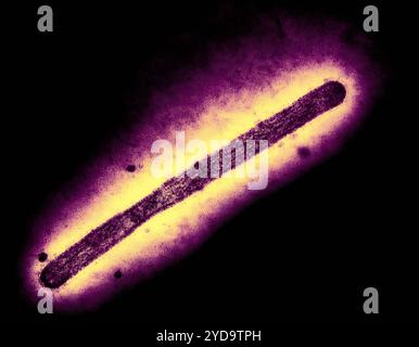 Trasmissione dell'immagine del microscopio elettronico di un virus dell'influenza A H5N1/influenza aviaria. Influenza A virus H5N1/influenza aviaria 016867 318 Foto Stock