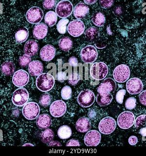 Micrografia elettronica a trasmissione colorata di particelle del virus mpox viola trovate all'interno di una cellula infetta di tè, coltivate in laboratorio. Virus Mpox 016867 378 Foto Stock
