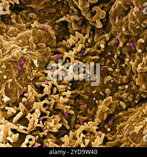 Micrografia elettronica a scansione colorata del virus mpox viola sulla superficie dell'abbronzatura infetta delle cellule VERO E6. Virus Mpox 016867 372 Foto Stock