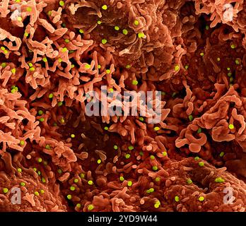 Micrografia elettronica a scansione colorata di particelle virali mpox verdi sulla superficie di cellule VERO E6 infette rosso. Virus Mpox 016867 374 Foto Stock