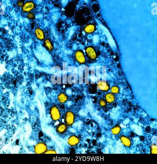 Micrografia elettronica a trasmissione colorata di particelle del virus mpox gialle trovate all'interno di una cellula infetta blu, coltivata in laboratorio. Virus Mpox 016867 385 Foto Stock