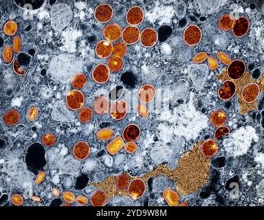 Micrografia elettronica a trasmissione colorata di particelle del virus mpox rosso e giallo trovati all'interno delle cellule di VERO E6 infette blu. Le particelle del virus sono in vari stadi di maturità, che spiega le differenze di forma. Questa immagine presenta anche fabbriche di virus marrone, che sono inclusioni all'interno di cellule infette dove si verifica la replicazione del virus, la maturazione e l'assemblaggio. Virus Mpox 016867 388 Foto Stock