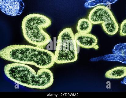 Micrografia elettronica a trasmissione colorata di particelle di virus Nipah extracellulare maturo verde vicino alla periferia di un blu cellulare VERO infetto. Particelle di virus Nipah 016867 434 Foto Stock