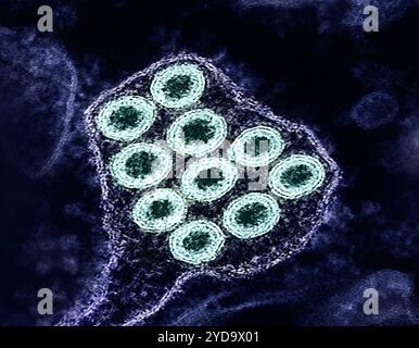 Micrografia elettronica a trasmissione colorata di particelle di virus della rabbia verde. Virus della rabbia 016867 457 Foto Stock