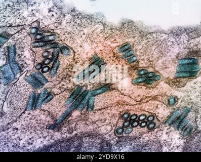 Micrografia elettronica a trasmissione colorata di particelle del virus della rabbia color ottanio. Pubblicato per commemorare la giornata mondiale delle malattie tropicali trascurate il 30 gennaio. La rabbia è una delle malattie tropicali più trascurate nelle regioni sottoservite del mondo. Secondo l'Organizzazione Mondiale della Sanità, provoca circa 59.000 morti umane all'anno. Colpisce in modo sproporzionato le popolazioni rurali povere e i bambini con un accesso limitato ai servizi sanitari e veterinari. Virus della rabbia 016867 458 Foto Stock