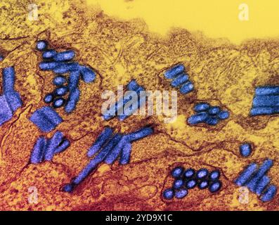 Micrografia elettronica a trasmissione colorata di particelle di virus della rabbia blu. Pubblicato per commemorare la giornata mondiale delle malattie tropicali trascurate il 30 gennaio. La rabbia è una delle malattie tropicali più trascurate nelle regioni sottoservite del mondo. Secondo l'Organizzazione Mondiale della Sanità, provoca circa 59.000 morti umane all'anno. Colpisce in modo sproporzionato le popolazioni rurali povere e i bambini con un accesso limitato ai servizi sanitari e veterinari. Virus della rabbia 016867 461 Foto Stock